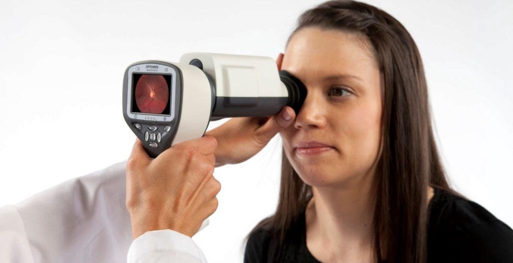 Smartscope-X: Affordable, accessible and automatic screening solution for diabetic retinopathy